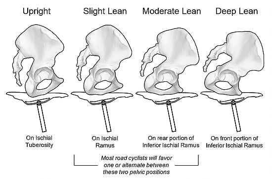 Pelvic Positions